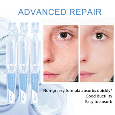 KOEC Korean 4D Hyaluronic Acid & Collagen Anti-Aging Skincare Face Serum Vials (Step 1)